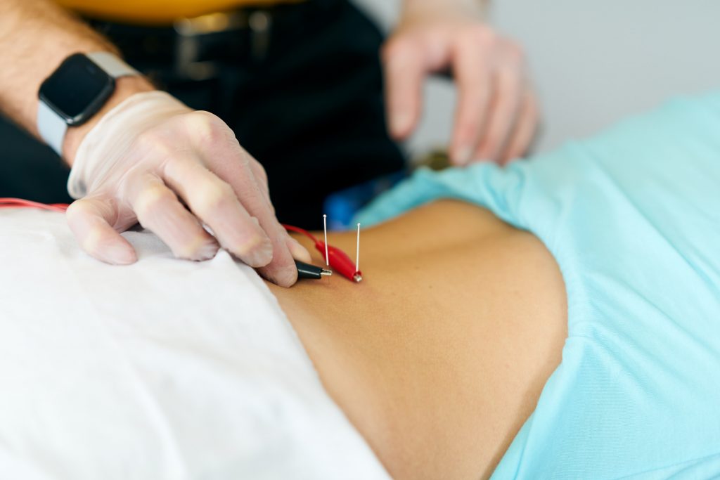 Functional Dry Needling® Clinical Integration • Courses by EIM