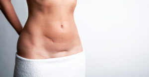 PelvicPostop scaled
