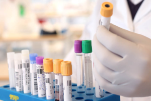Svar Life Science male lab technician standing in laboratory holding blood sample 1